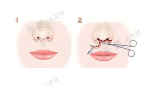珠海九龙男科医院治疗早泄的成效好吗