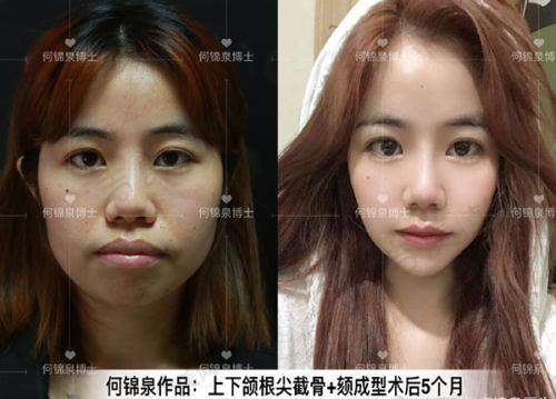珠海九龙整形医院的优势在哪里