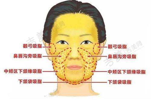 上海美代口腔门诊部口腔正颌手术专长