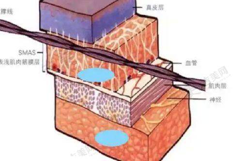 选择成都中医 大银海整形白振华医生的理由：技术、经验与服务俱佳