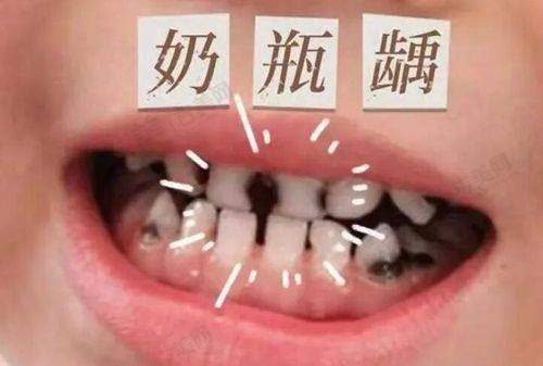武汉美齐口腔医院3B直丝弓矫正成效好吗