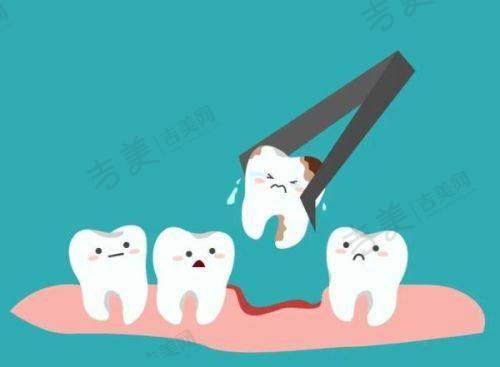 成都团圆口腔医院特色项目有哪些?