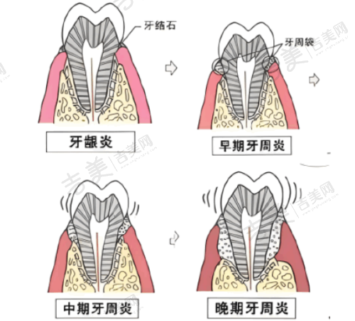 武汉皓诺口腔医院矫正优势明显吗