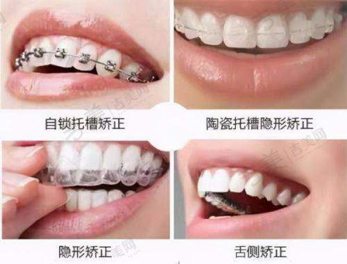 武汉中诺口腔医院怎么样