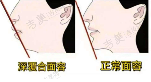 武汉爱齿尔口腔医院技术咋样