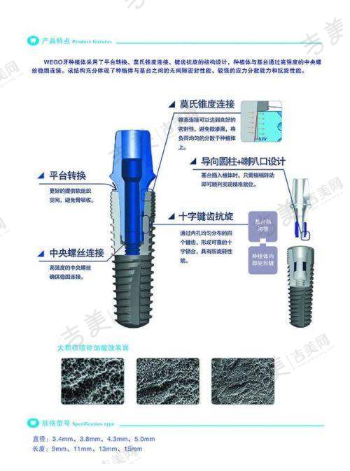 武汉隐乐口腔医院隐形矫正特色有哪些