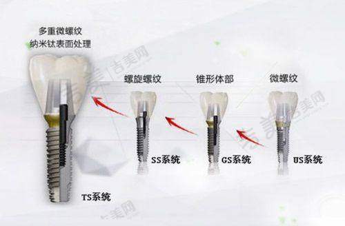 成都团圆口腔医院技术设备精良吗?