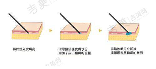 杭州同荣丽格医疗美容医院项目特色