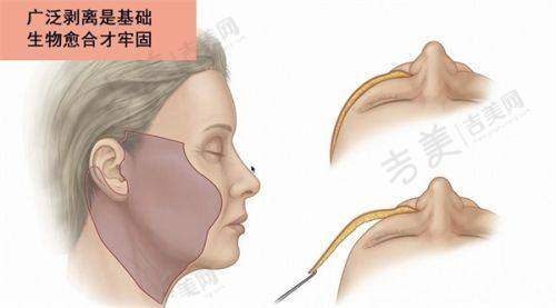七、深圳欢乐丽格医疗美容诊所口碑好不好？附真实患者口碑评价