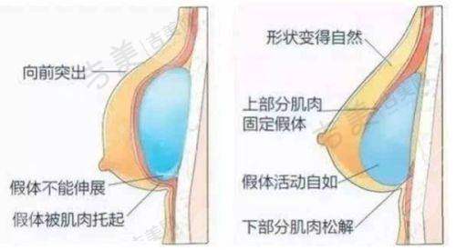 珠海九龙男科医院割包皮手术规范吗