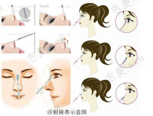 上海薛瑾口腔高品质口腔服务确保