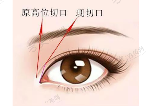 李菁医生的技术优势亮点