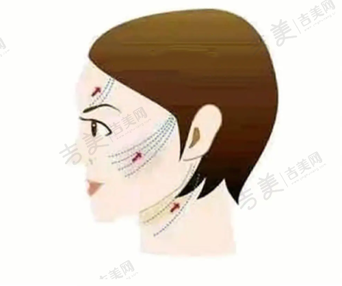 重庆徐铎丽格整形美容医院价格表