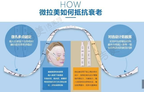 广州丽港丽格医疗美容门诊部口碑好不好？附真实患者口碑评价