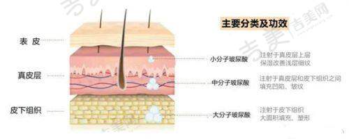 李菁医生擅长的医美项目