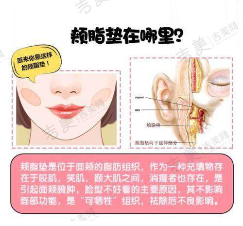 李可君医生擅长的母乳喂养及隆胸项目