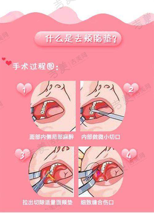 珠海九龙整形医院张成春医生有哪些优势