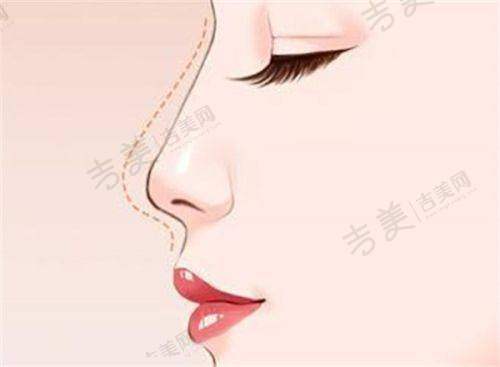 珠海九龙男科医院治疗肾虚有什么特色