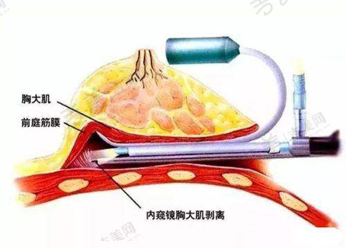 昆山优艺谋医疗美容:打造舒适美容体验的专精机构