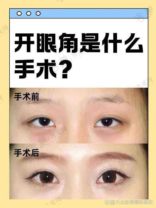 张志兵医生的个人资料与经验优势