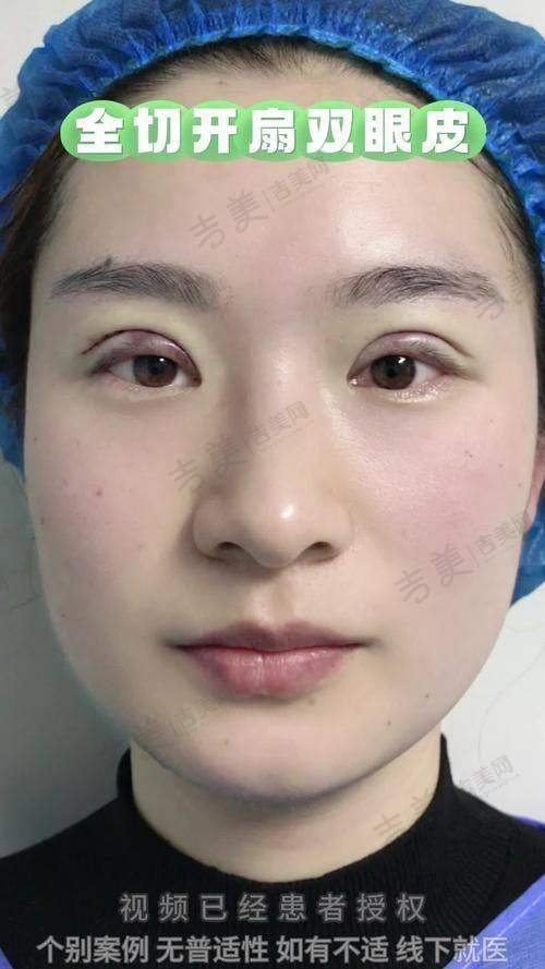 昆山花度蜜美医疗美容:多样化美容项目的一站式体验
