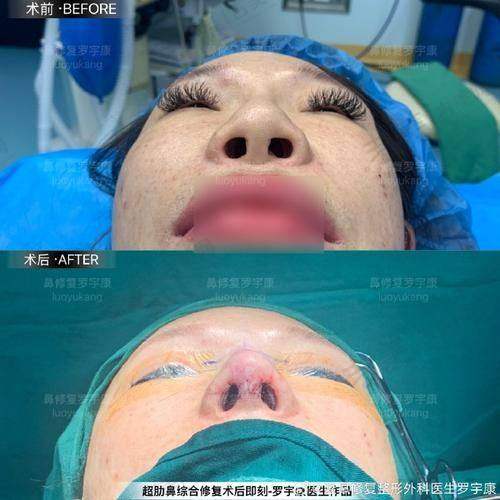 南宁健丽医疗美容门诊部价格表