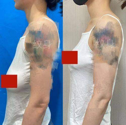 杭州健丽医疗美容门诊部口碑好不好?附真实患者口碑评价
