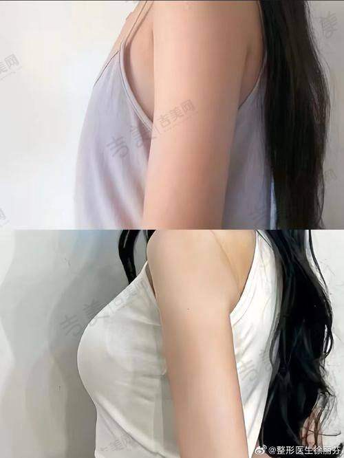 北京岩之畔医巢医疗美容门诊部口碑好不好？附真实患者口碑评价