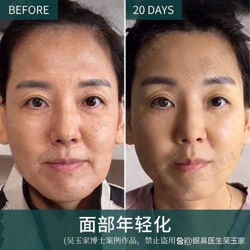 北京岩之畔医巢医疗美容门诊部项目特色