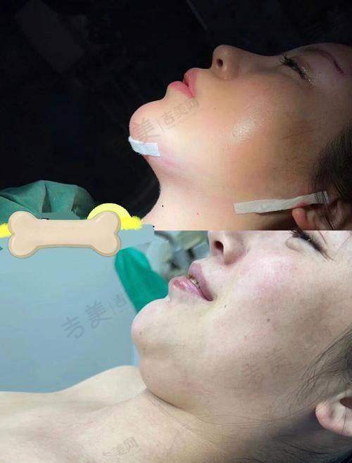 深圳鹏程整形——规模与技术并重的小能手
