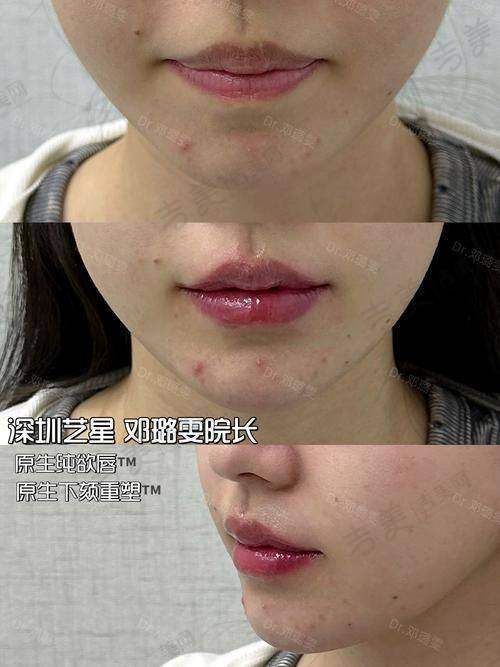 深圳健丽医疗美容门诊部怎么样，口碑评价如何？
