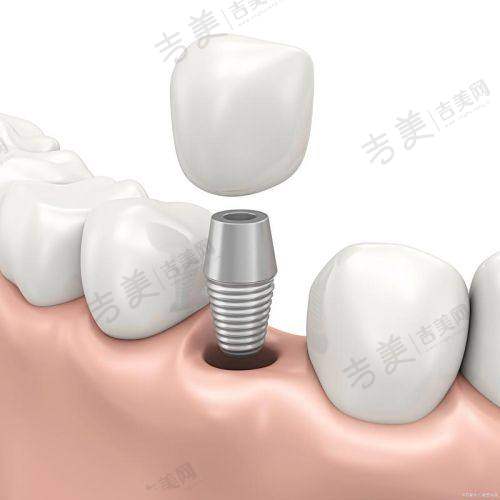 南通海门名扬口腔：综合性的海门口腔健康守护者