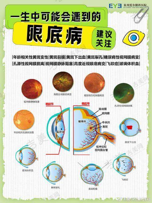 昆明普瑞眼科医院地址及乘车路线