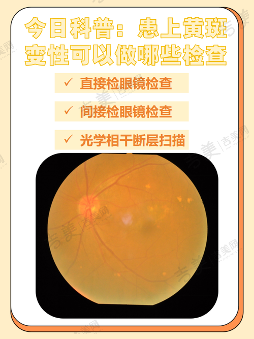郑州视光眼科医院项目特色