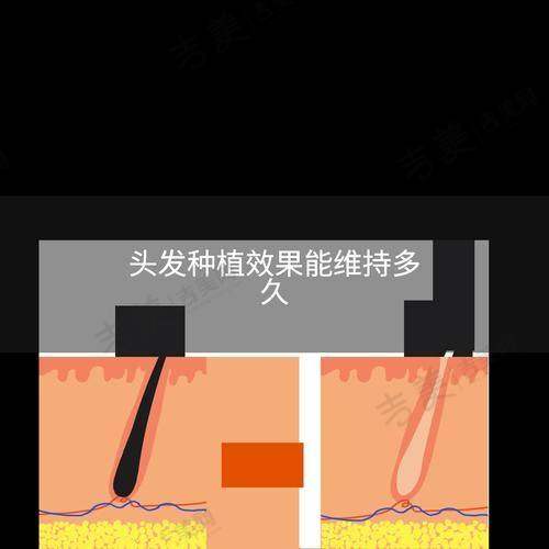 昆明美诗沁医疗美容门诊部项目特色