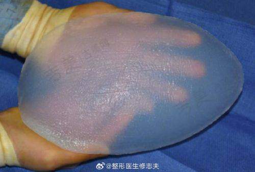 天津健丽医疗美容门诊部怎么样,口碑评价如何