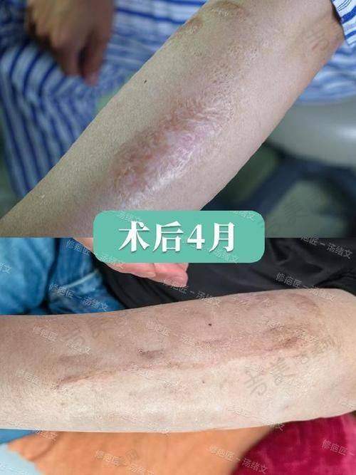 苏州美诗沁医疗美容门诊部项目特色