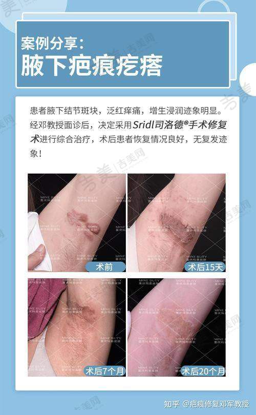 成都疤研疤痕医院的医疗团队怎么样