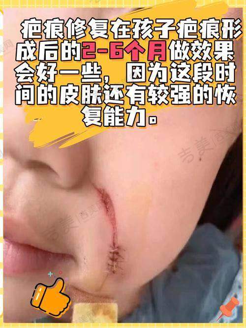 成都疤研疤痕医院的地址和乘车路线