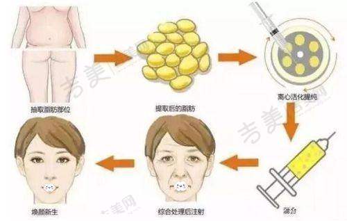 上海健丽医疗美容门诊部项目特色
