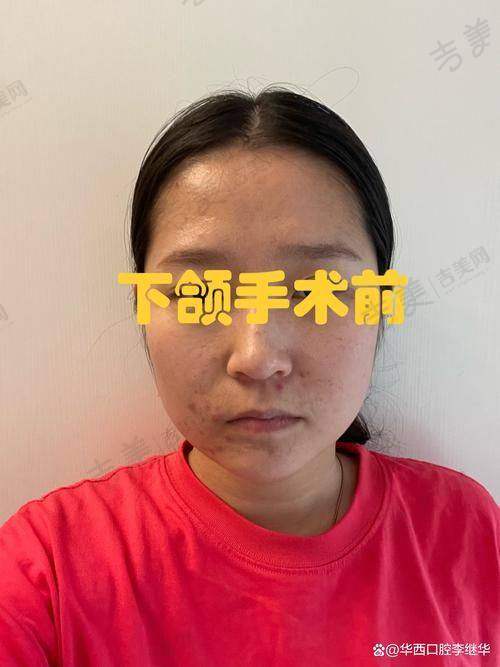 深圳美莱整形——美胸领域的梦幻工厂