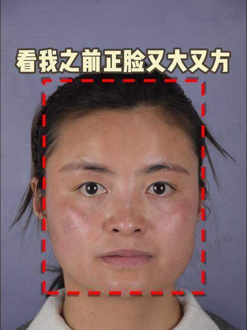 深圳南雅整形——形体与抗衰的魔法师