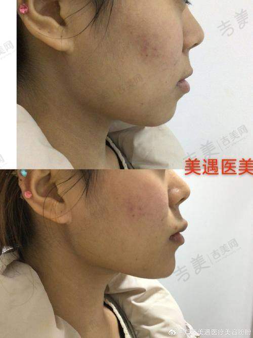 深圳阳光整形——医美行业的老牌劲旅