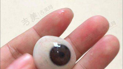 昆明普瑞眼科医院怎么样，口碑评价如何？
