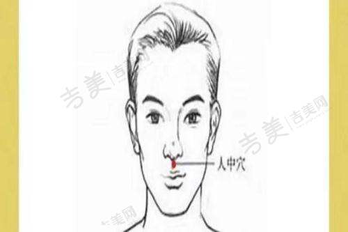 杨迪眼周筋膜提升值得尝试吗？
