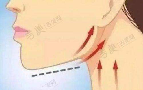 南京去眼袋骨干医生哪个好?其他医院的非凡代表