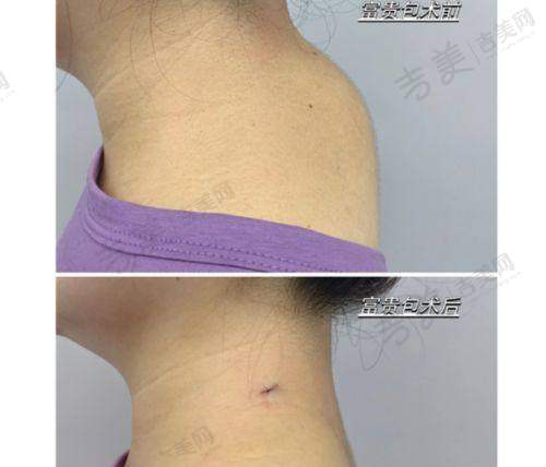 [兰州时光整形医院]七、兰州时光整形医院口碑好不好？附真实患者口碑评价