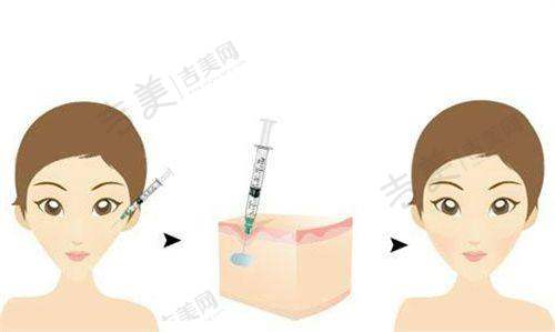 桂林181医院整形科简介全新来袭：眼部整形项目有哪些优势？