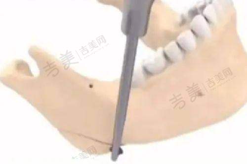 桂林181医院整形科简介全新来袭：皮肤美容项目怎么样？