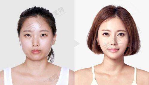 杭州格莱美医疗美容医院：特色项目显优势